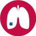 Atemnot kann auf eine Lungen embolie hinweisen!